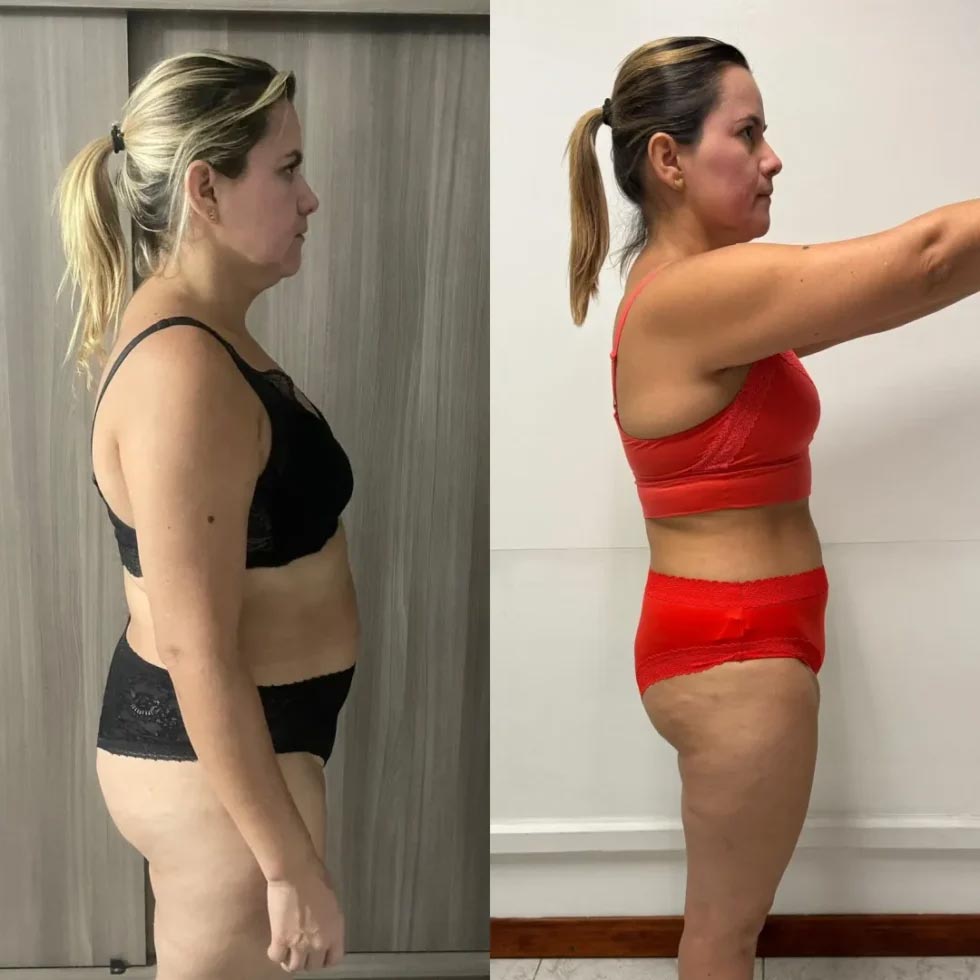 Transformación real 1